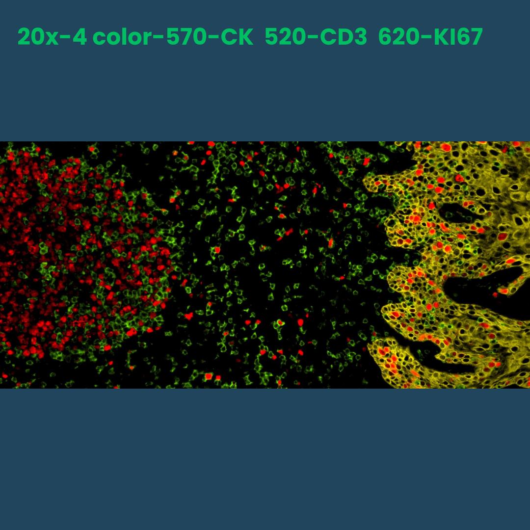 4-color multiplex fluorescence IHC detection kit (rabbit-on-rodent) - Celnovte Biotechnology