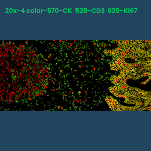 4-color multiplex fluorescence IHC detection kit (rabbit-on-rodent) - Celnovte Biotechnology