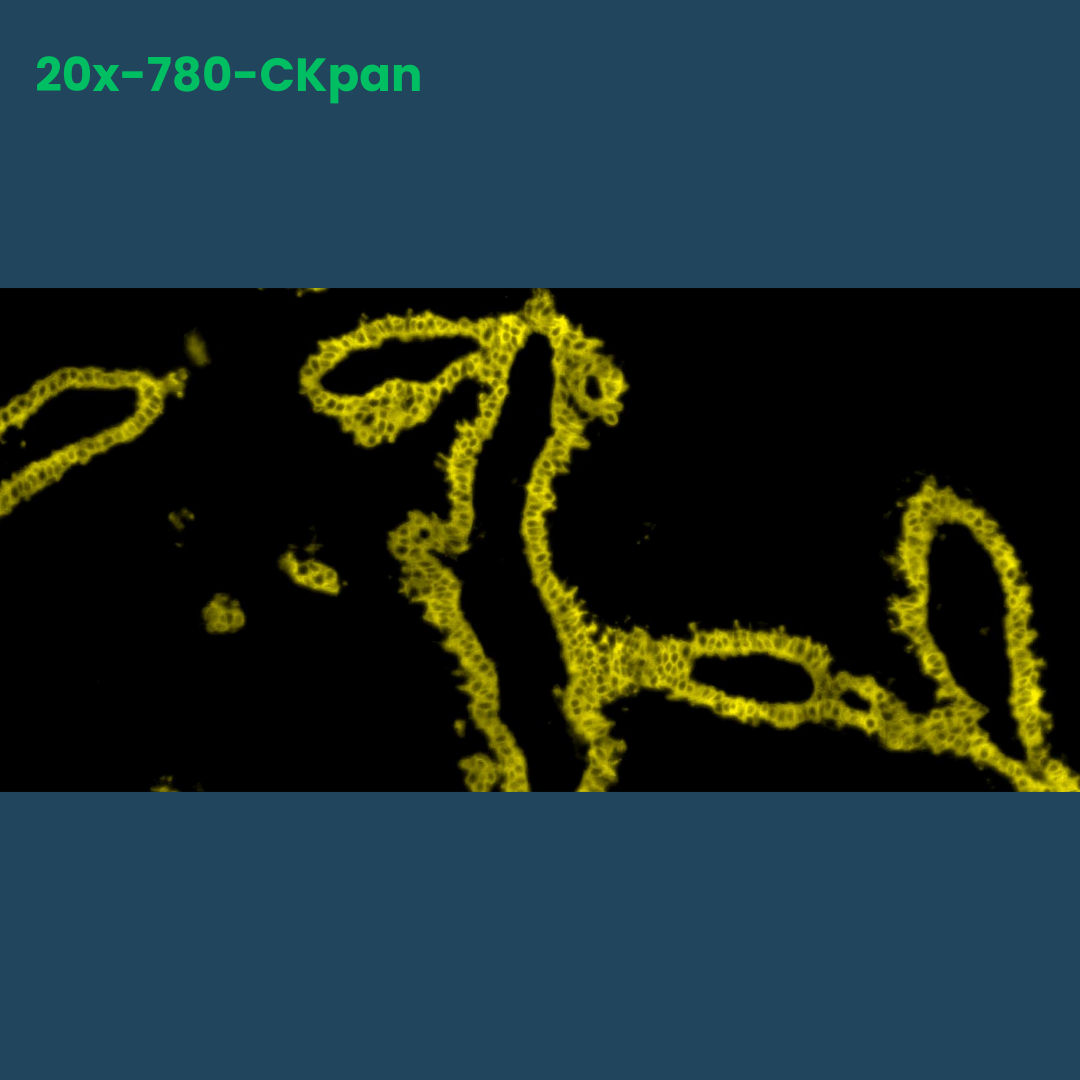 TSA Fluorophore CM780 - Celnovte Biotechnology