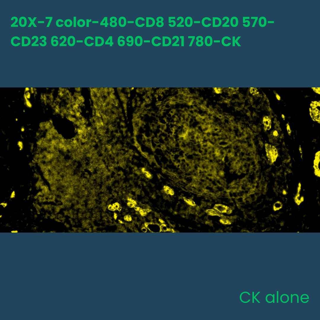 7-color multiplex fluorescence
