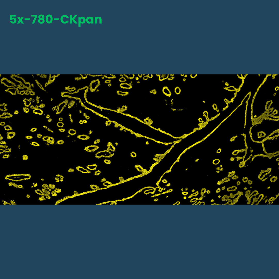 TSA Fluorophore CM780 - Celnovte Biotechnology