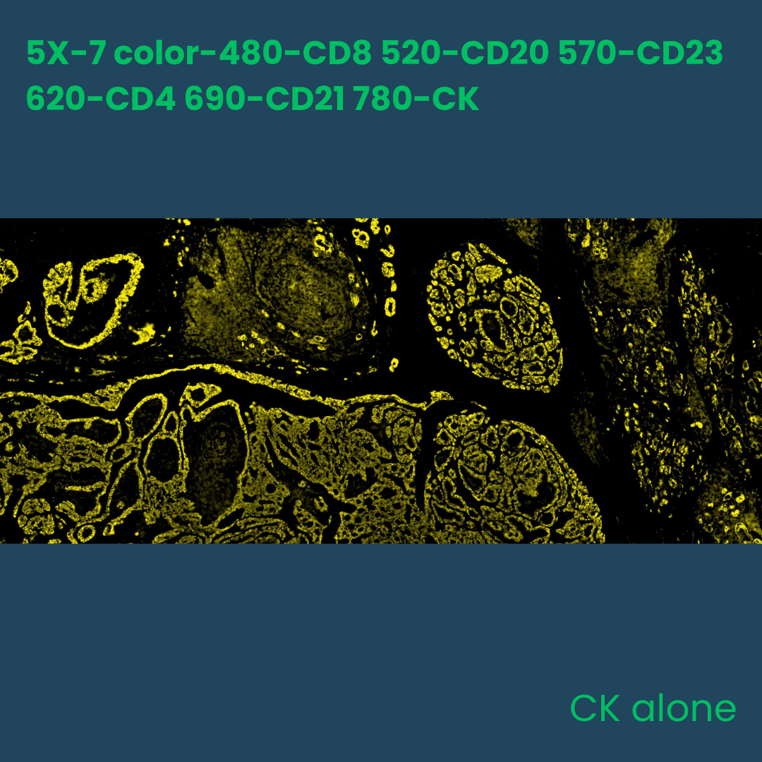 7-color multiplex fluorescence