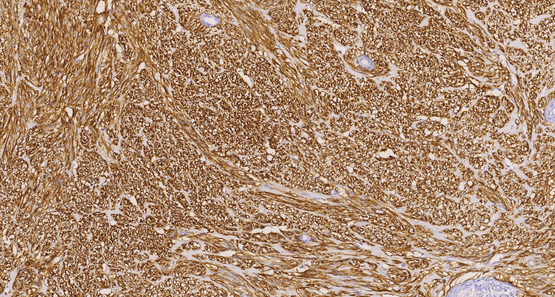 DOG1(C2E3), MMab - Celnovte Biotechnology