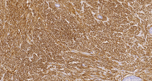 DOG1(C2E3), MMab - Celnovte Biotechnology