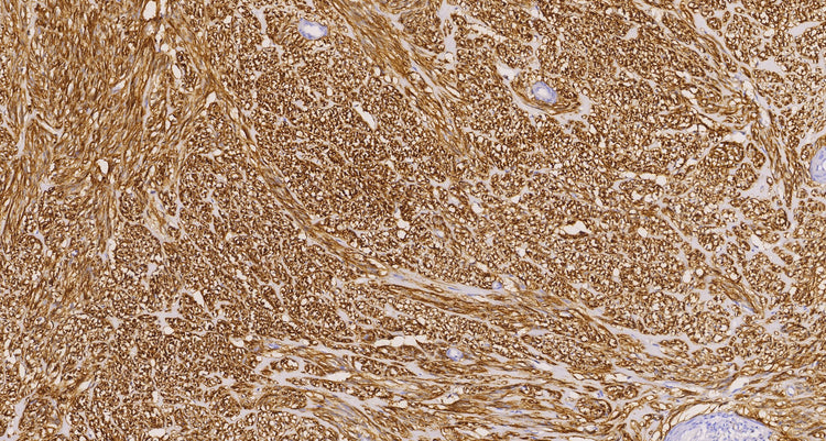 DOG1(C2E3), MMab - Celnovte Biotechnology