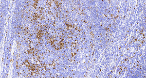 MUM1(C6H9), MMab - Celnovte Biotechnology