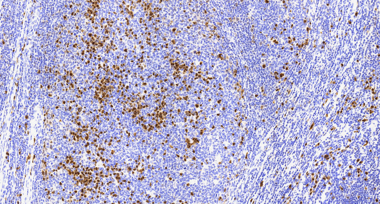 MUM1(C6H9), MMab - Celnovte Biotechnology