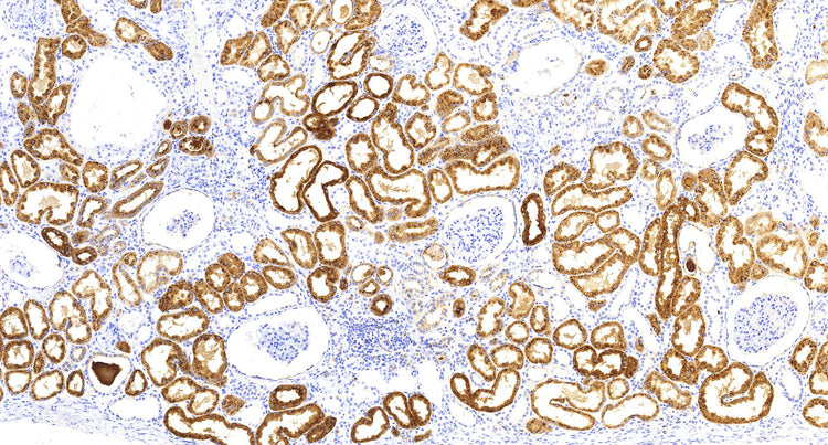 Napsin A(C2C2), MMab