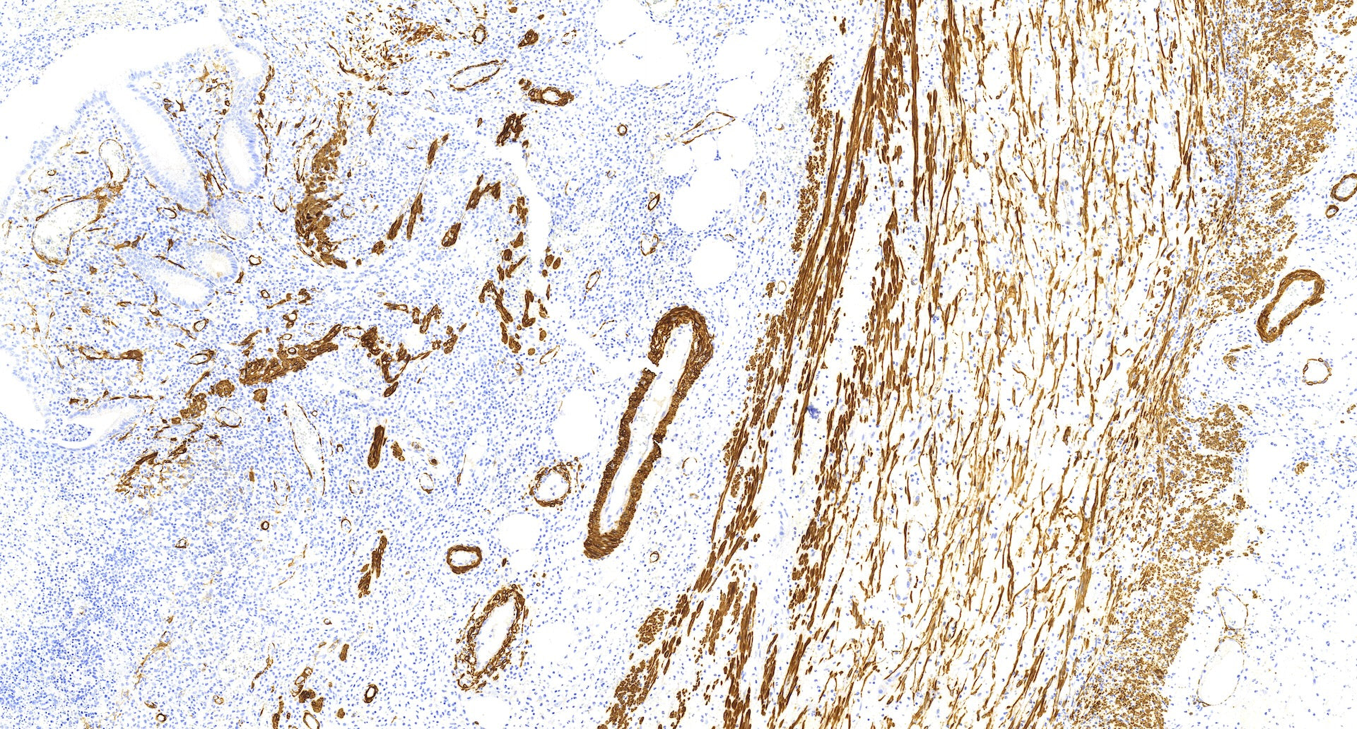 SMA(C1C1), MMab - Celnovte Biotechnology