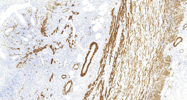 SMA(C1C1), MMab - Celnovte Biotechnology