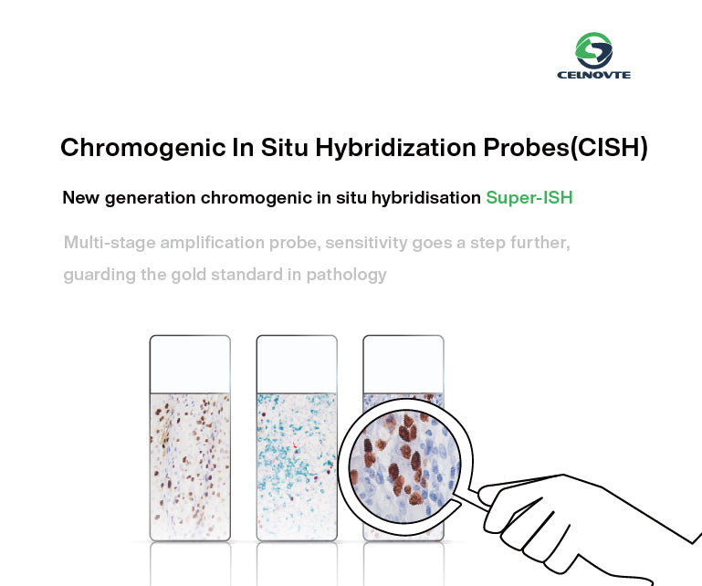 Super-ISH™：Albumin mRNA in-situ Hybridization Assists in the Diagnosis of Hepatocellular Carcinoma