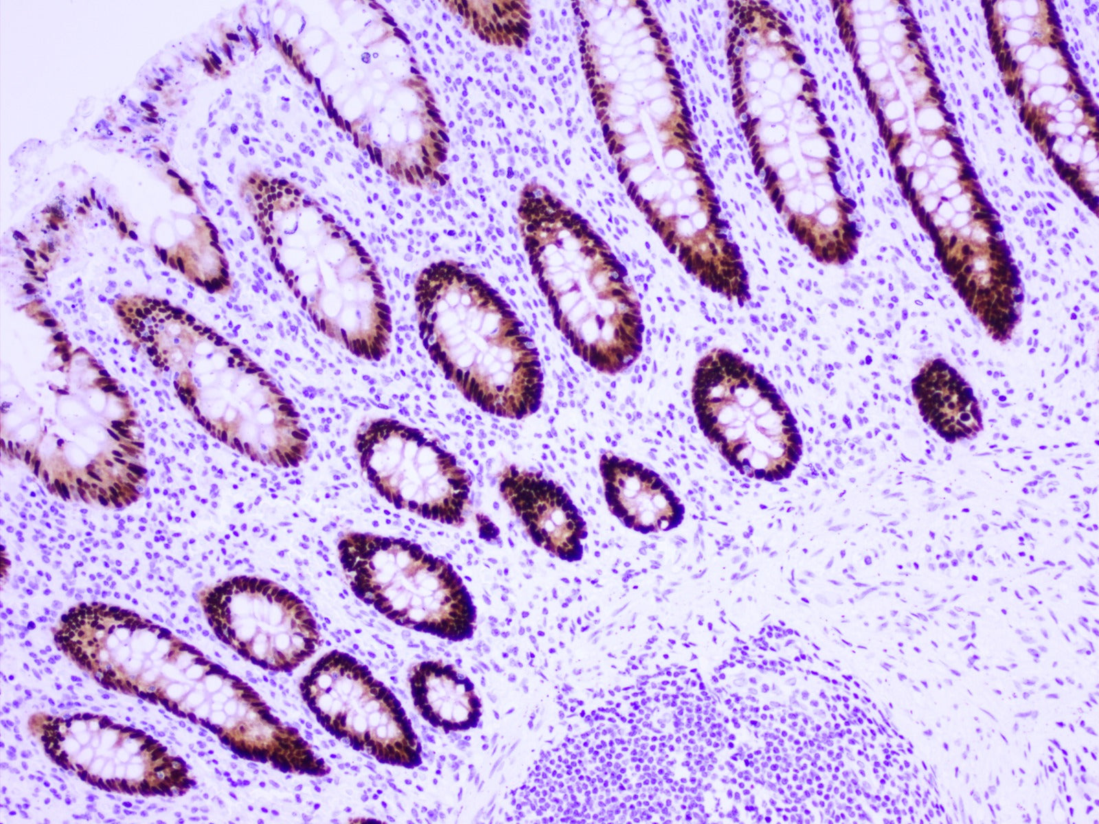 MicroStacker™ Ultra Polymer Detection Kit