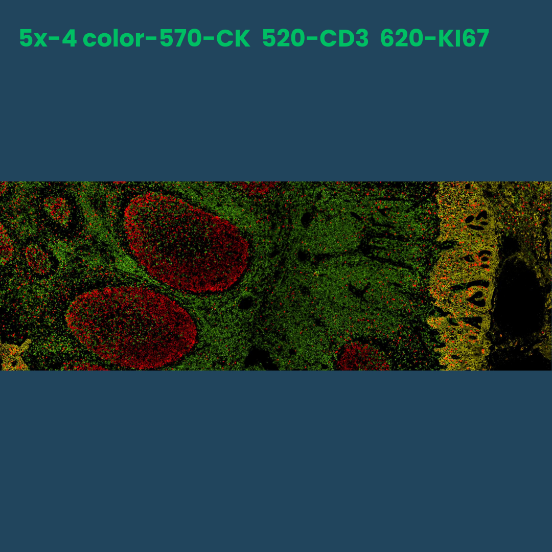 4-color multiplex fluorescence IHC detection kit