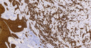 Cytokeratin 5 & 6(C6H1/C1C8), MMab