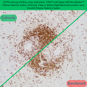 CD79a staining of kidney using rmAb (clone: C9E27) with (Upper Left) MicroStacker™ Polymer Detection System, Enhanced, 2-step or (Bottom Right) Benchmark product: Leica Novolink Polymer Detection System