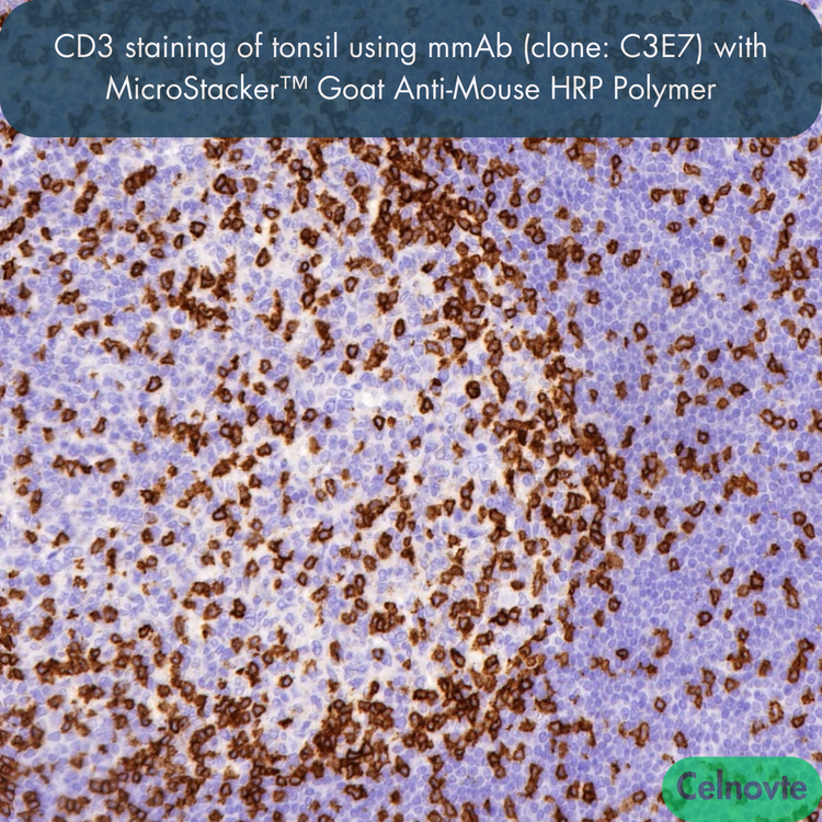 CD3 staining of tonsil using mmAb (clone: C3E7) with MicroStacker™ Goat Anti-Mouse HRP Polymer