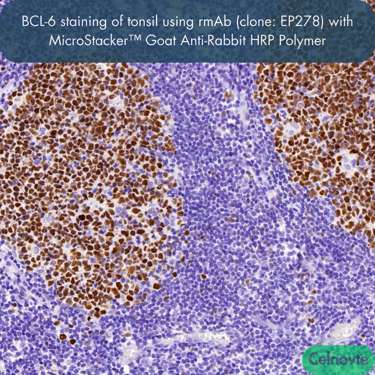 BCL-6 staining of tonsil using rmAb (clone: EP278) with MicroStacker™ Goat Anti-Rabbit HRP Polymer