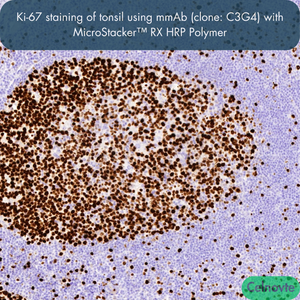 Ki-67 staining of tonsil using mmAb (clone: C3G4) with MicroStacker™ RX HRP Polymer