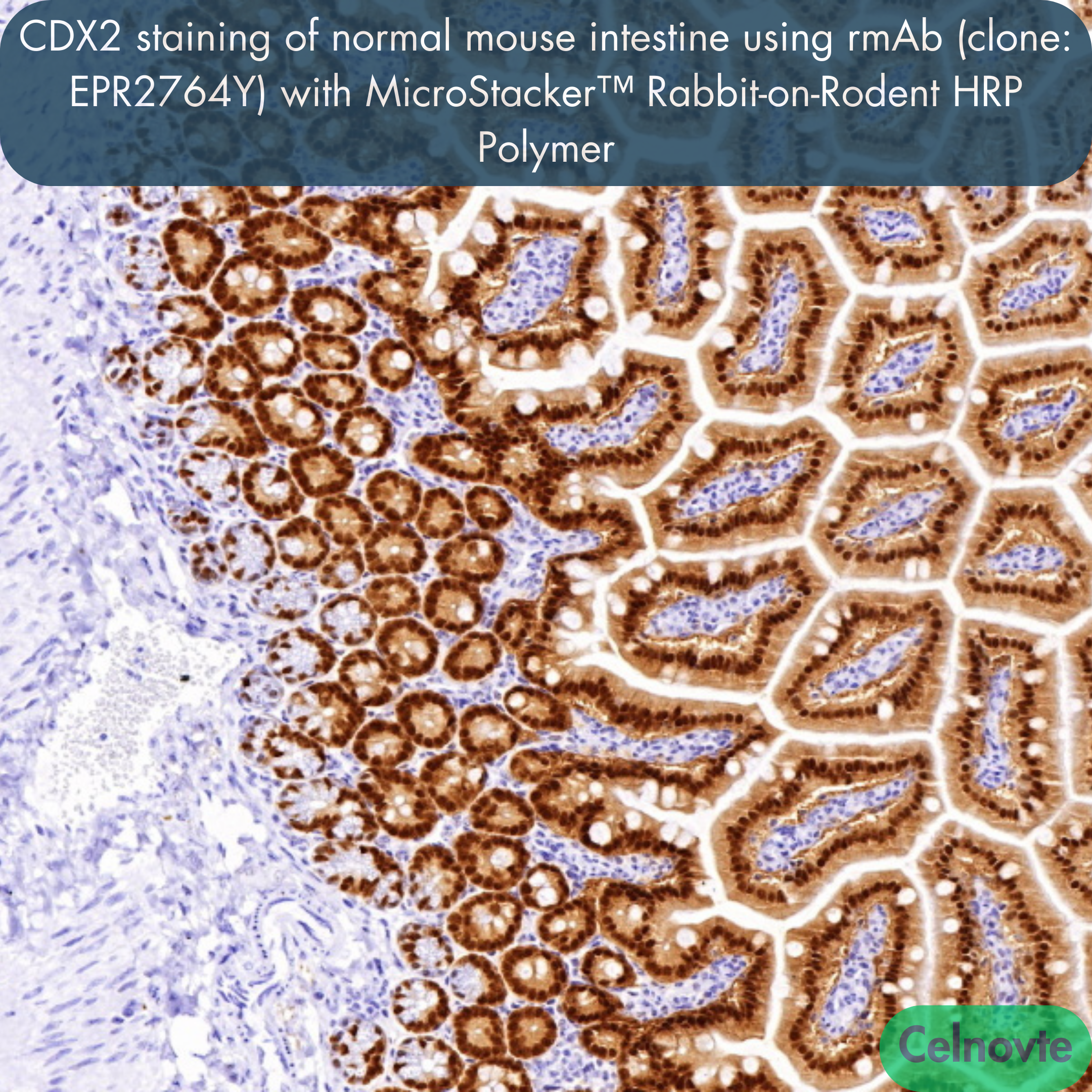 CDX2 staining of normal mouse intestine using rmAb (clone: EPR2764Y) with MicroStacker™ Rabbit-on-Rodent HRP Polymer