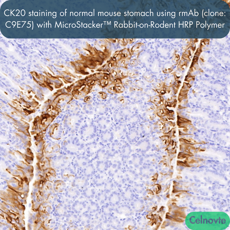 CK20 staining of normal mouse stomach using rmAb (clone: C9E75) with MicroStacker™ Rabbit-on-Rodent HRP Polymer