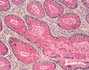 Mucicarmine Staining Kit